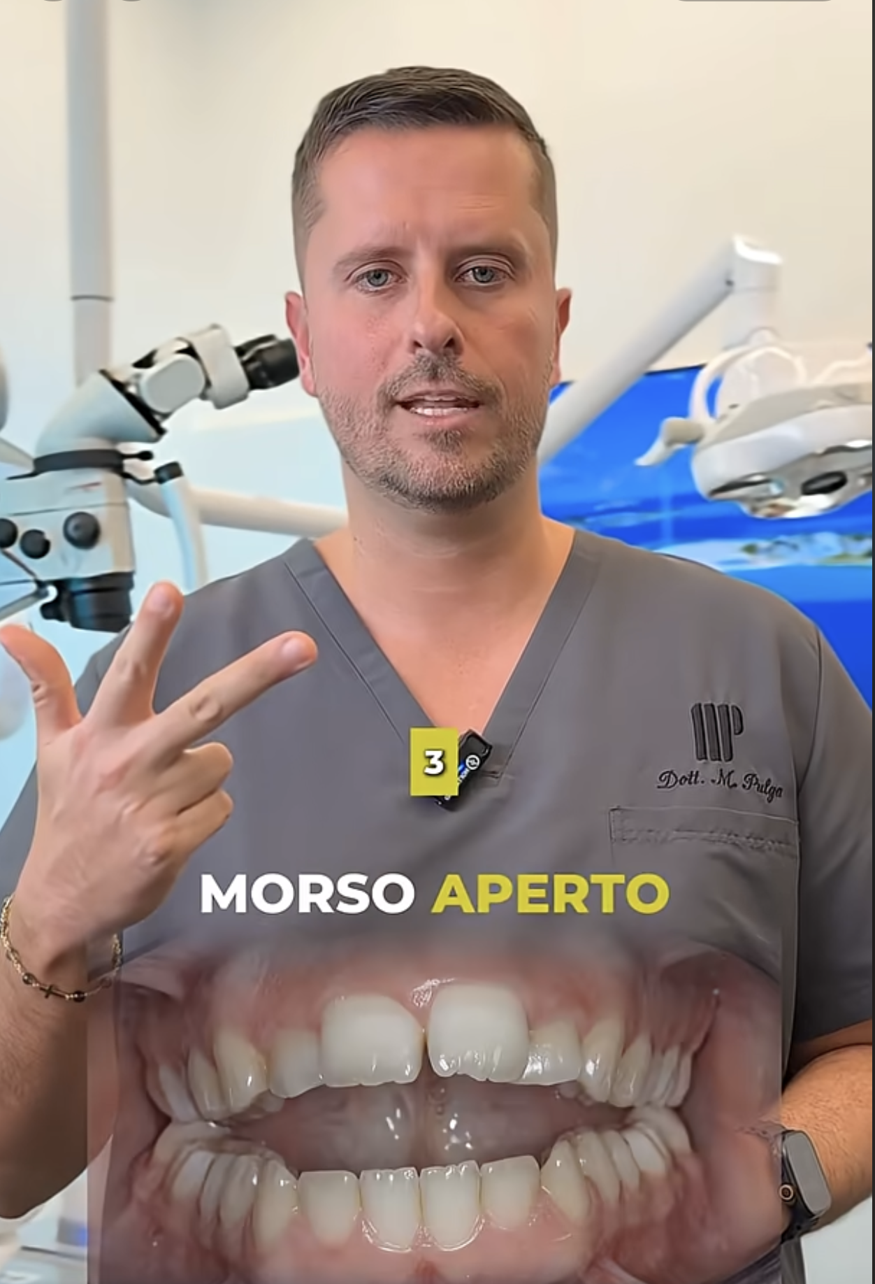 Morso aperto