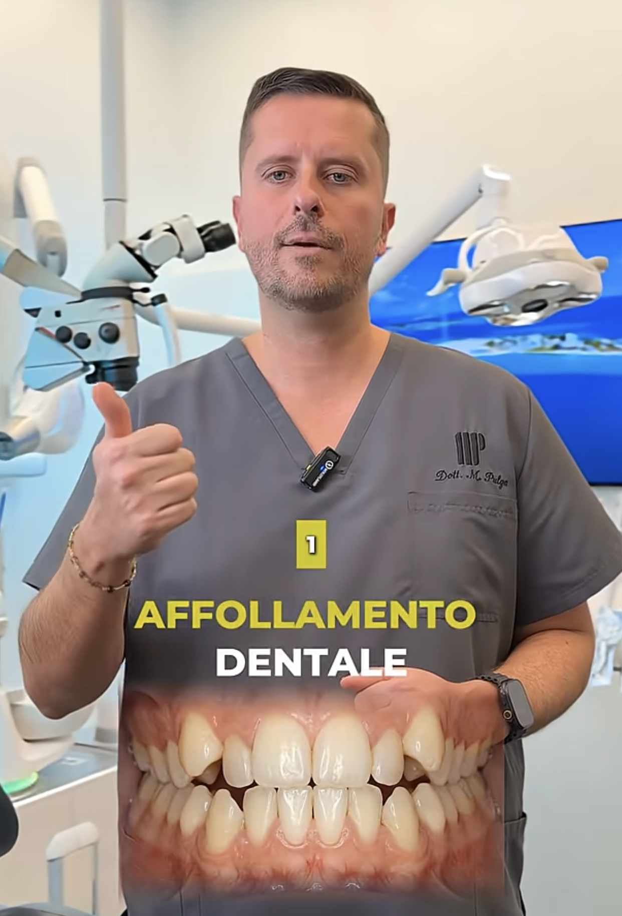 affollamento dentale