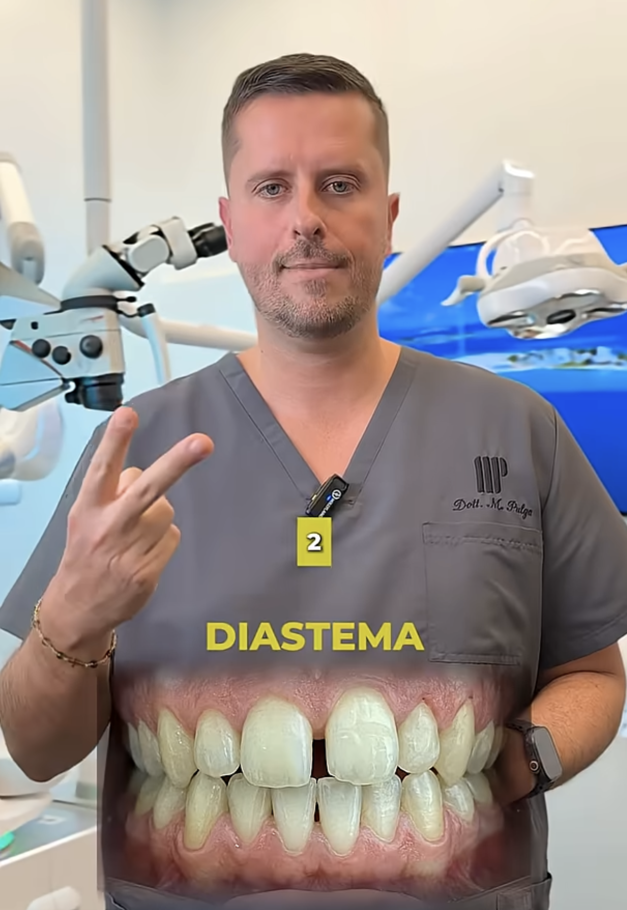 diastema